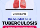 Alerta por tuberculosis en Argentina: los casos aumentaron 80% en cinco años   
